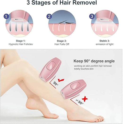 ✨ IPL Laser Hair Removal